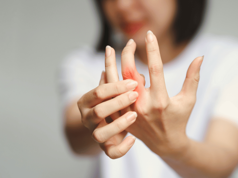 Rheumatoid Arthritis